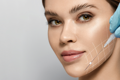 Revitalizing Aesthetic Trends: The Full Face Thread Lift Unveiled